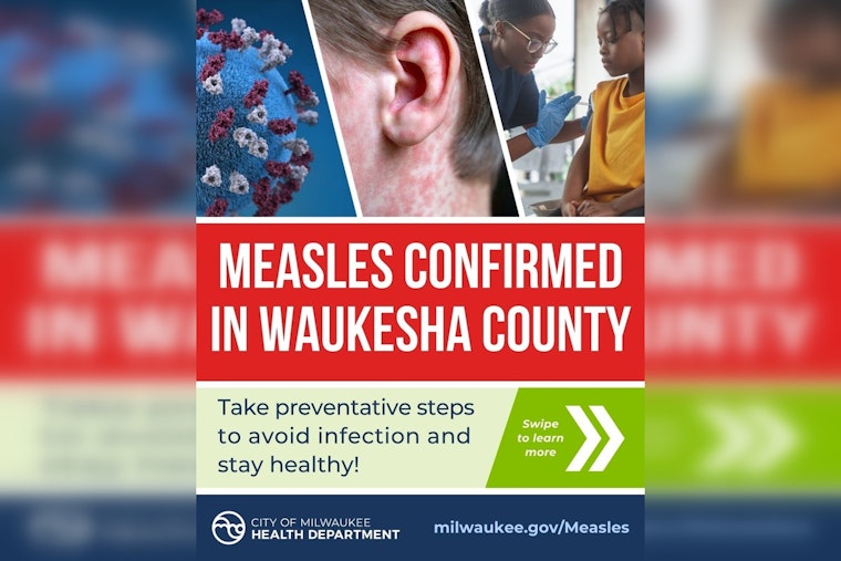 Measles Outbreak Confirmed in Milwaukee as Health Officials Urge Vaccination and Hygiene Measures