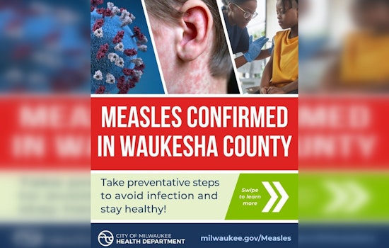 Measles Outbreak Confirmed in Milwaukee as Health Officials Urge Vaccination and Hygiene Measures