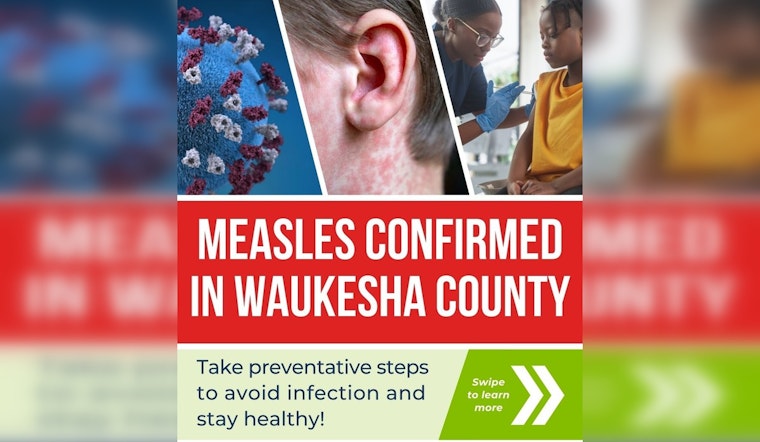 Measles Outbreak Confirmed in Milwaukee as Health Officials Urge Vaccination and Hygiene Measures