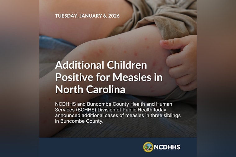 NC Health Officials Issue Measles Outbreak Alert in Buncombe County, Urge Vigilance and Vaccination