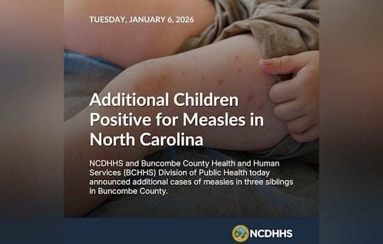 NC Health Officials Issue Measles Outbreak Alert in Buncombe County, Urge Vigilance and Vaccination