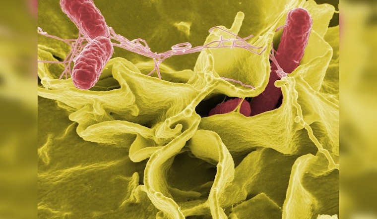 Salmonella Scare! "Live It Up" Supplement Powder Sparks Massive Recall in Illinois, Wisconsin and Beyond