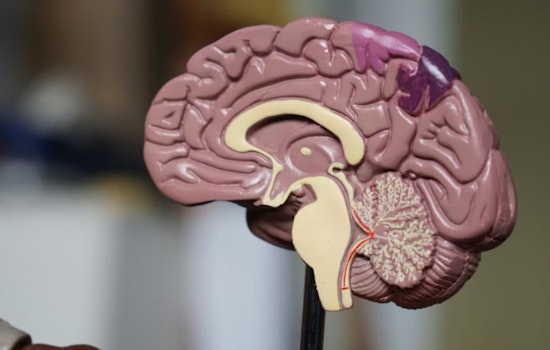 Seattle Brain Gadget Helps Stroke Survivor Get His Grip Back