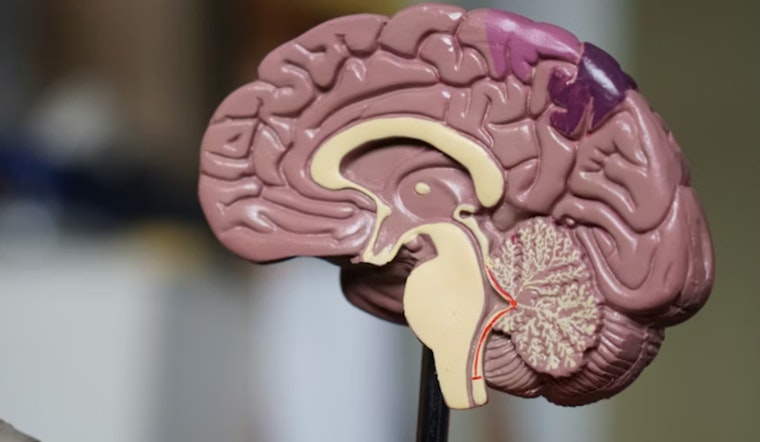 Seattle Brain Gadget Helps Stroke Survivor Get His Grip Back