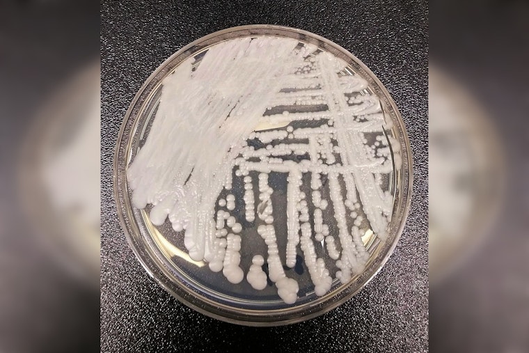 Stealth Superbug Fungus Invades California Hospitals, Hitting Sickest Patients Hardest