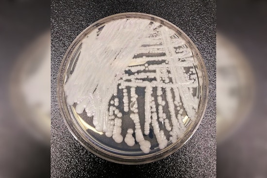 Stealth Superbug Fungus Invades California Hospitals, Hitting Sickest Patients Hardest