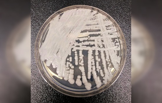 Stealth Superbug Fungus Invades California Hospitals, Hitting Sickest Patients Hardest
