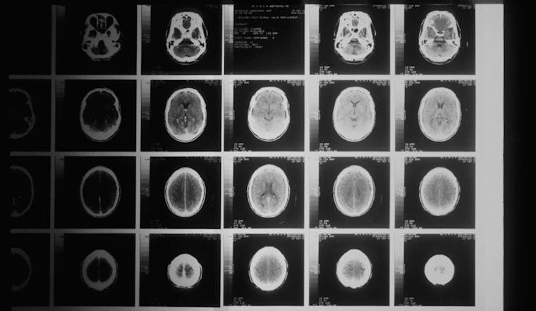 University of Cincinnati Research Shines at International Stroke Conference 2026 in New Orleans