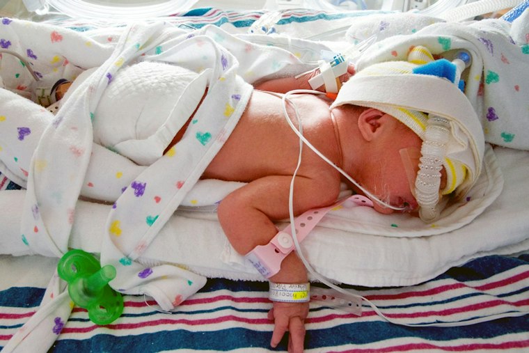 Decatur Baby Born at 1 Pound Marks One Year Since Leaving Emory NICU