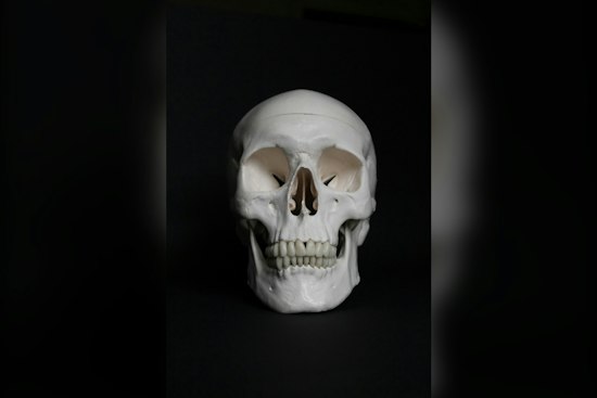 Dog Finds Human Skull Near Boone Water Intake, Medical Examiner Now Investigating