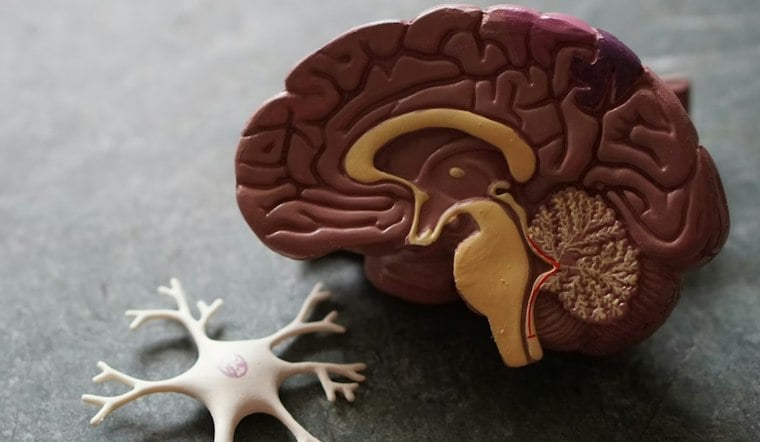 Worcester’s UMass Chan Lands $4.1M to Probe Metals’ Link to Alzheimer’s