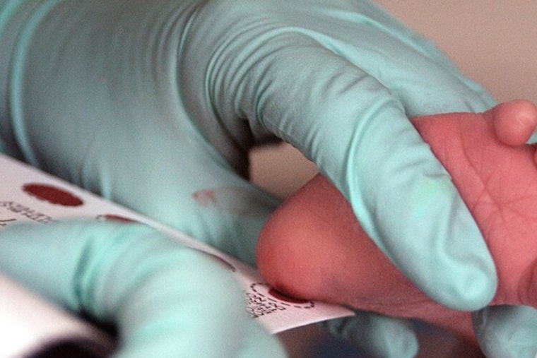 After Collin’s Death, Wisconsin Rushes To Add Krabbe Test For Newborns
