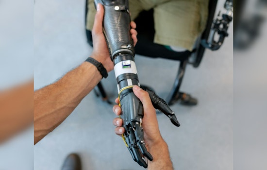 Austin Startup Lets Amputees Control Robotic Limbs By Thought