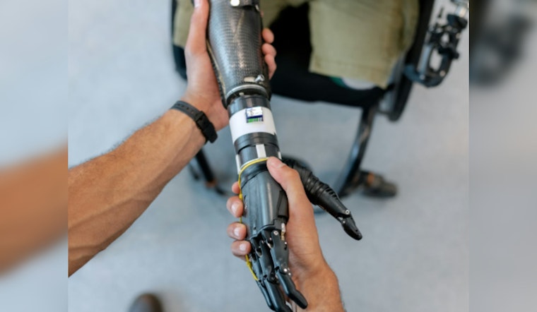 Austin Startup Lets Amputees Control Robotic Limbs By Thought