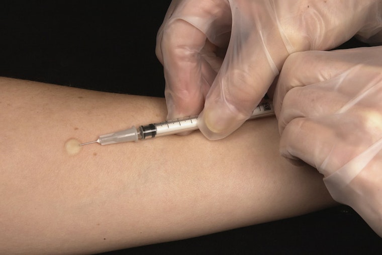 Camden County On Edge After Resident Tests Positive For Active Tuberculosis