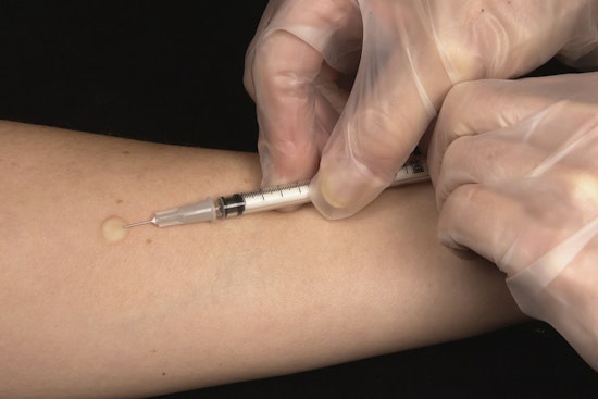 Camden County On Edge After Resident Tests Positive For Active Tuberculosis