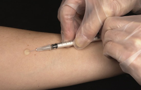 Camden County On Edge After Resident Tests Positive For Active Tuberculosis