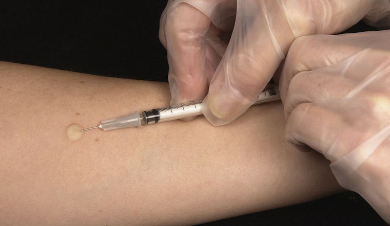 Camden County On Edge After Resident Tests Positive For Active Tuberculosis