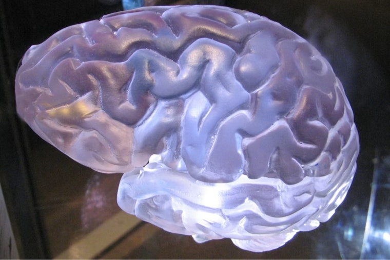 Cleveland Clinic Bets On Brain-Reading AI To Catch Seizures In Seconds