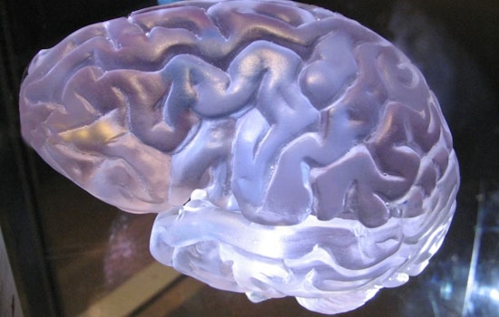 Cleveland Clinic Bets On Brain-Reading AI To Catch Seizures In Seconds