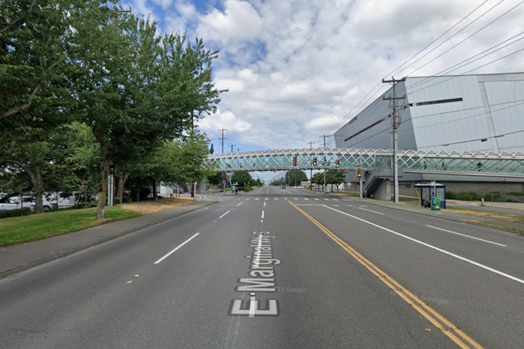 Cops Say Wrong-Way Tukwila Driver Sank Teeth Into Officer During DUI Stop
