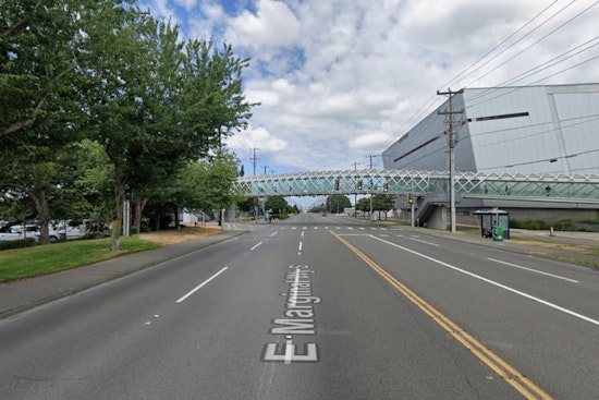 Cops Say Wrong-Way Tukwila Driver Sank Teeth Into Officer During DUI Stop