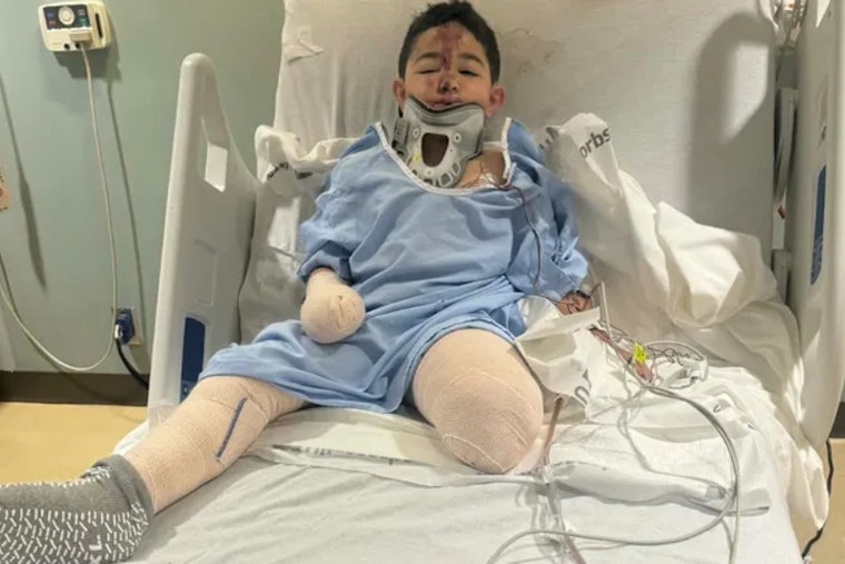 Dallas 8-Year-Old Home At Last After New Year’s Crash Costs Him His Leg