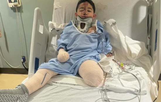 Dallas 8-Year-Old Home At Last After New Year’s Crash Costs Him His Leg