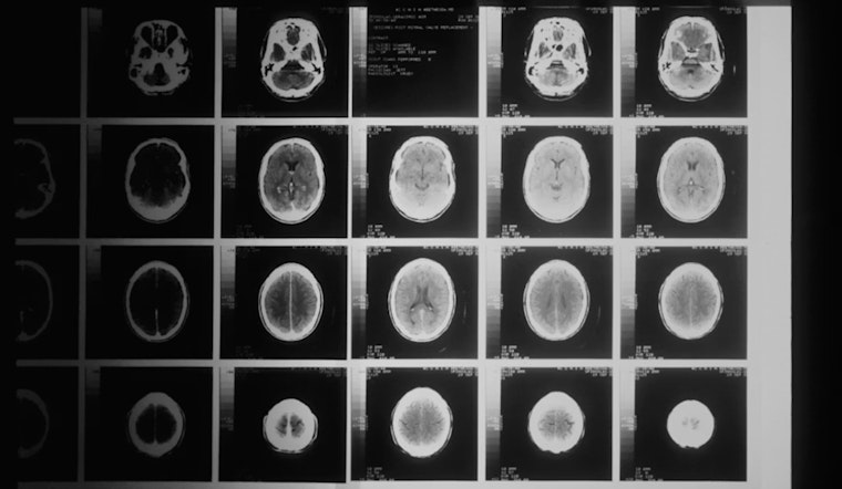 Fort Collins Brain Doc’s Headset Test Warns When Your Mind Is Aging Too Fast