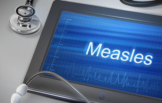N.C. Sounds Measles Alarm With Live Town Hall For Worried Parents