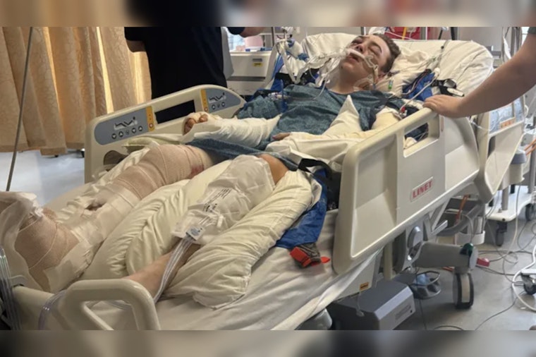 Olympia Teen Left With 43 Broken Bones After Suspected I‑5 DUI Hit-and-Run