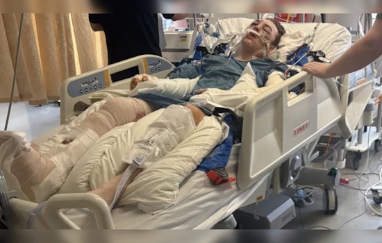 Olympia Teen Left With 43 Broken Bones After Suspected I‑5 DUI Hit-and-Run