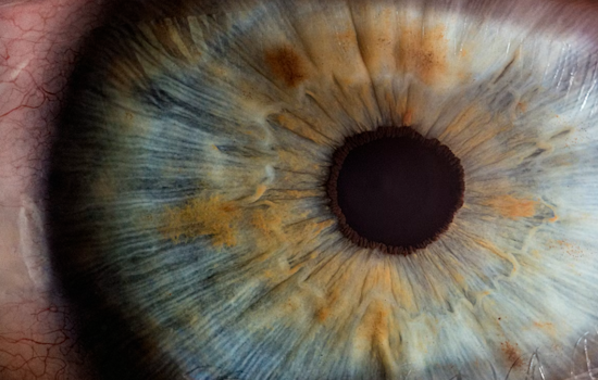 ‘Tiny Eye Chip’ Lets Pittsburgh Woman Read Again After Macular Degeneration Ordeal