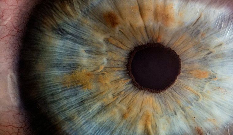‘Tiny Eye Chip’ Lets Pittsburgh Woman Read Again After Macular Degeneration Ordeal