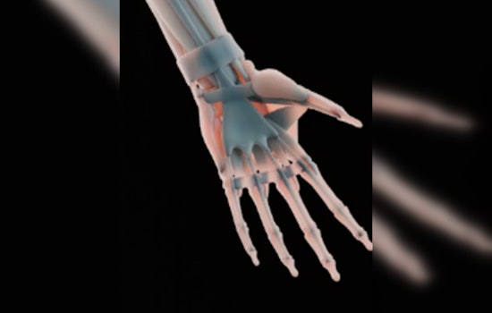 UT Austin’s Cheap 3D Hand Could Give Cadavers a Run for Their Money