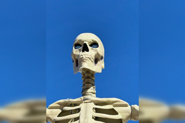 Boneheaded Heist As Medway’s Beloved ‘Kevin’ Skeleton Loses His Head