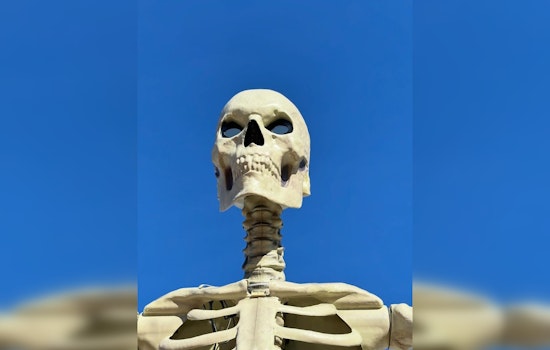 Boneheaded Heist As Medway’s Beloved ‘Kevin’ Skeleton Loses His Head