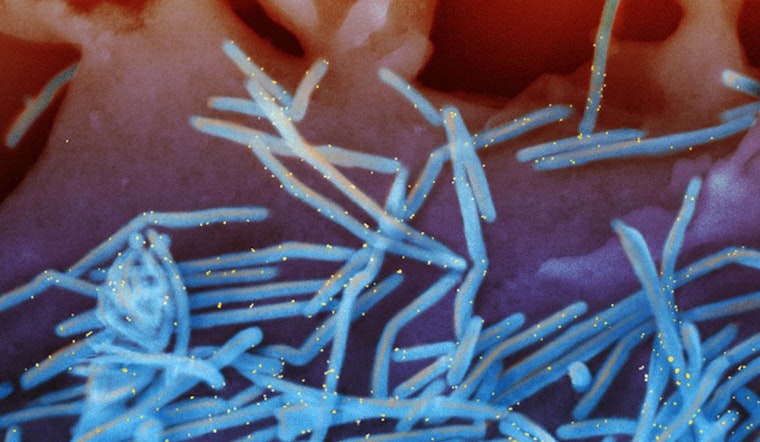 Chicago RSV Surge Could Extend Infant Immunizations