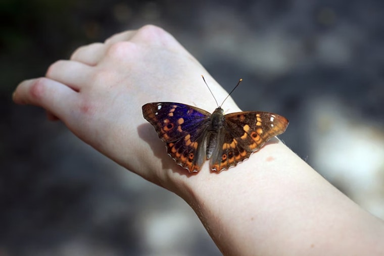 Cincy 'Butterfly' Warrior Inspires D.C. Push To Slash $80K Bandage Bills