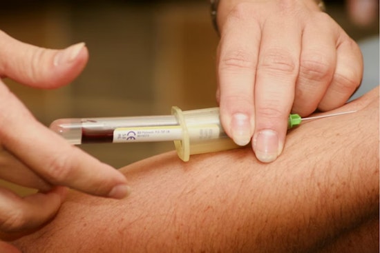 Cleveland’s Cholesterol Wake-Up Call: New Rules Could Put More Residents On Statins