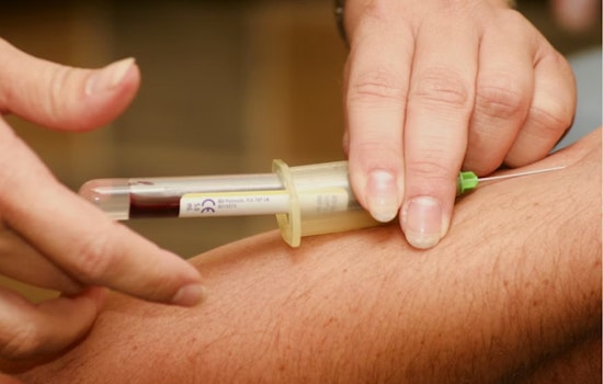 Cleveland’s Cholesterol Wake-Up Call: New Rules Could Put More Residents On Statins