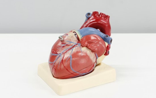 Early Menopause Linked to 40% Higher Risk of Heart Attacks