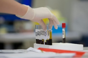 Ex-L.A. Sheriff's Custodian Microwaved DUI Sample