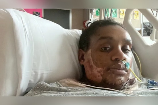 Jax Mom Hit With Scalding Grease Now Braces for Eviction Before Baby Arrives