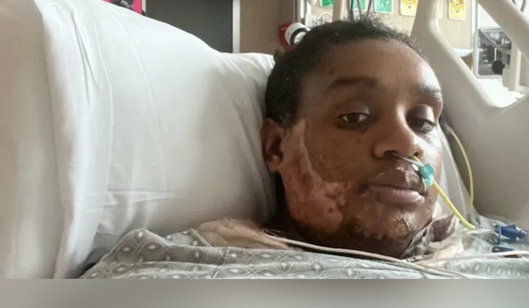 Jax Mom Hit With Scalding Grease Now Braces for Eviction Before Baby Arrives