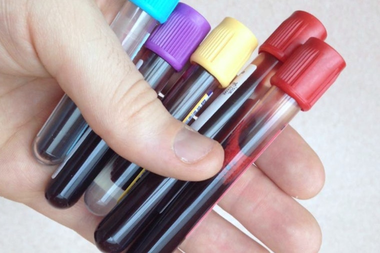 Jehovah's Witnesses Loosen Blood Rules, Let Flock Stash Their Own Supply