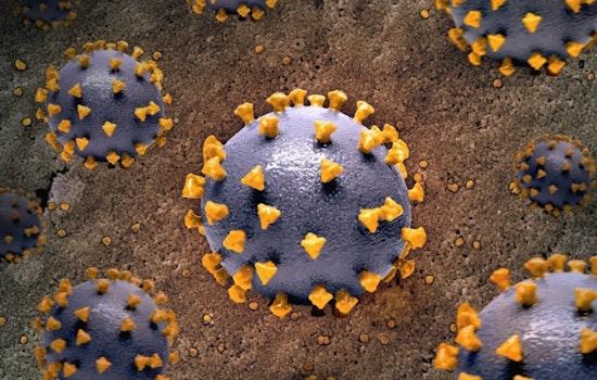 Measles Scare Spreads From Primary Children’s Er To Holladay Megaplex Screens