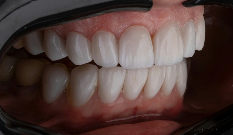 Memphis Woman Says Facebook Veneers Wrecked Her Smile