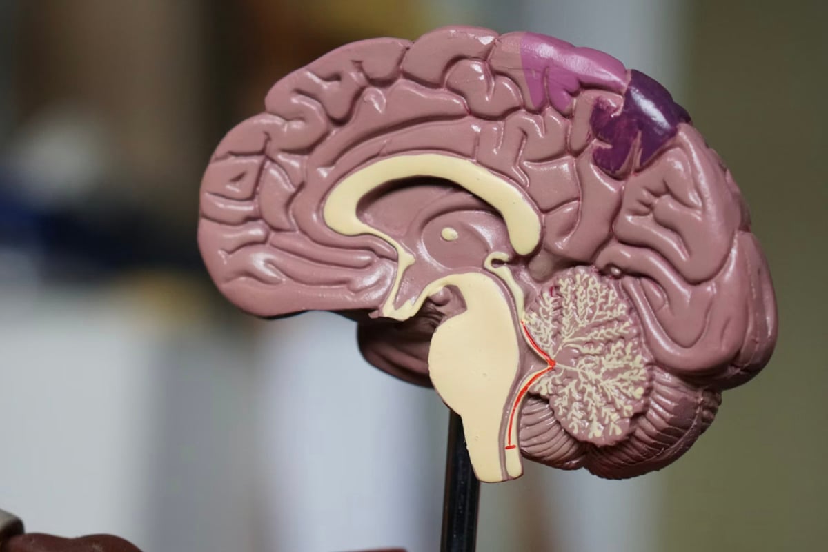 MIT Brain Team Blames Tiny RNA For Rett’s Leaky Vessel Problem