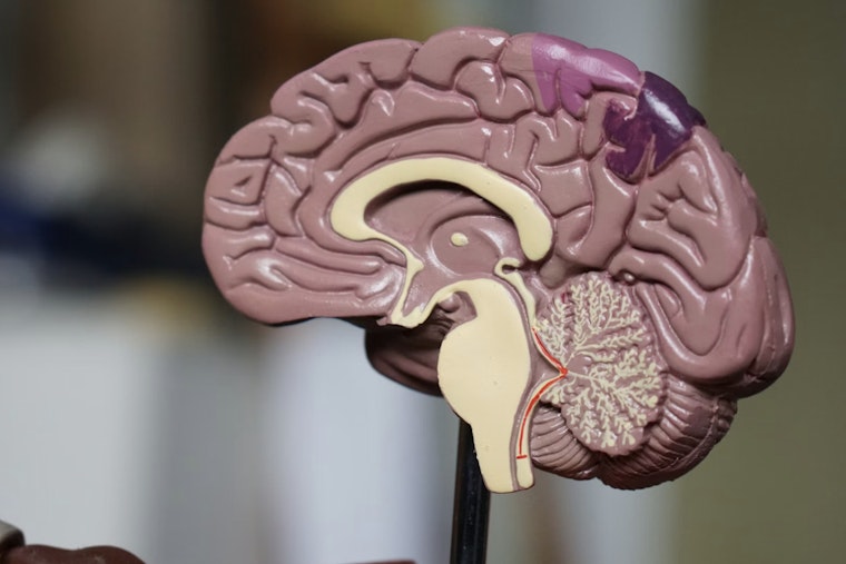 MIT Brain Team Blames Tiny RNA For Rett’s Leaky Vessel Problem